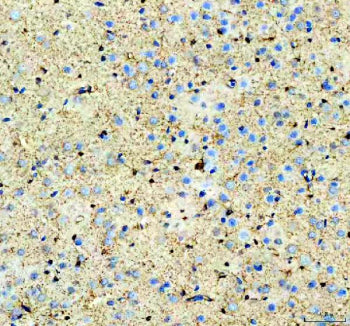 Immunohistochemical staining of Aldolase C/ALDOC using anti-ALDOC antibody. Aldolase C/ALDOC was detected in a paraffin-embedded section of rat brain tissue. Heat mediated antigen retrieval was performed in EDTA buffer (pH 8.0, epitope retrieval solution). The tissue section was blocked with 10% goat serum. The tissue section was then incubated with 2 ug/ml rabbit anti-ALDOC antibody overnight at 4oC. Peroxidase Conjugated Goat Anti-rabbit IgG was used as secondary antibody and incubated for 30 min at 37oC.