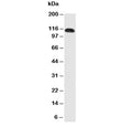 Western blot testing of CEACAM5 antibody and human SW620 cell lysate. Expected molecular weight: 80~200 kDa depending on glycosylation level.