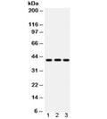 Western blot testing of 1) human U87, 2) human HepG2 and 3) mouse brain lysate with HLA-A antibody. Expected/observed molecular weight ~41 kDa.