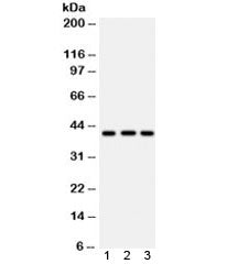 Western blot testing of 1) human U87, 2) human HepG2 and 3) mouse brain lysate with HLA-A antibody. Expected/observed molecular weight ~41 kDa.