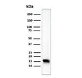 Western blot testing of human HeLa cell lysate using recombinant Fatty Acid Binding Protein 5 antibody (clone FABP5/6353R). Predicted molecular weight ~15 kDa.
