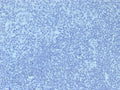 IHC staining of FFPE human tonsil tissue with Mouse IgG2a Isotype Control antibody (clone IGG2a/6723). HIER: boil tissue sections in pH 9 10mM Tris with 1mM EDTA for 20 min and allow to cool before testing.