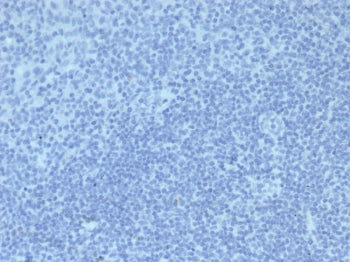 IHC staining of FFPE human tonsil tissue with Mouse IgG2a Isotype Control antibody (clone IGG2a/6723). HIER: boil tissue sections in pH 9 10mM Tris with 1mM EDTA for 20 min and allow to cool before testing.