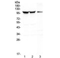 Western blot testing of 1) rat brain, 2) mouse brain and 3) mouse NIH3T3 lysate with Dynamin 1 antibody at 0.5ug/ml. Predicted molecular weight ~97 kDa.