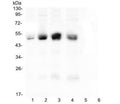 Western blot testing of human 1) A431, 2) HeLa, 3) HepG2, 4) Caco-2, 5) U973 and 6) THP1 cell lysate with CAR antibody at 0.5ug/ml. Expected molecular weight: 40-50 kDa.