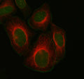 Immunofluorescent staining of FOXM1 using anti-FOXM1 antibody (green) and anti-Beta Tubulin antibody (red). FOXM1 was detected in immunocytochemical section of HELA cell. Enzyme antigen retrieval was performed using IHC enzyme antigen retrieval reagent for 15 mins. The cells were blocked with 10% goat serum. And then incubated with 5 ug/ml rabbit anti-FOXM1 antibody and mouse anti-Beta Tubulin antibody overnight at 4oC.