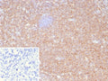 IHC staining of FFPE human tonsil tissue with HLA-B antibody (clone JOAN-1). HIER: boil tissue sections in pH 9 10mM Tris with 1mM EDTA for 20 min and allow to cool before testing.