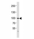 Western blot analysis of lysate from SW480 cell line using FGFR4 antibody at 1:1000. Observed molecular weight: 88~125 kDa depending on phosphorylation and glycosylation level.