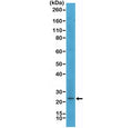 Western blot testing of human SK-MEL-2 cell lysate with recombinant MART1 antibody at 1:500. Expected molecular weight ~20 kDa with possible doublet.