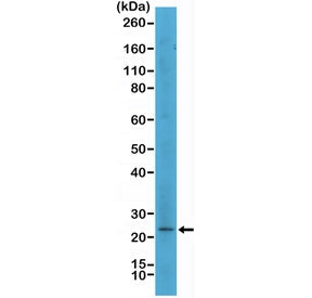 Western blot testing of human SK-MEL-2 cell lysate with recombinant MART1 antibody at 1:500. Expected molecular weight ~20 kDa with possible doublet.