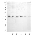 Western blot testing of 1) human 293T, 2) human Raji, 3) human ThP-1, 4) human HeLa, 5) rat RH35 and 6) mouse NIH 3T3 cell lysate with MAD2L1 antibody. Predicted molecular weight ~24 kDa.