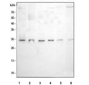 Western blot testing of 1) human 293T, 2) human Raji, 3) human ThP-1, 4) human HeLa, 5) rat RH35 and 6) mouse NIH 3T3 cell lysate with MAD2L1 antibody. Predicted molecular weight ~24 kDa.
