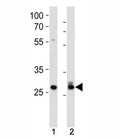 Cdk2 antibody western blot analysis in 293, HeLa lysate. Predicted molecular weight ~33 kDa.