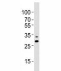 Western blot analysis of lysate from A431 cell line using PHB antibody diluted at 1:1000. Predicted molecular weight ~29 kDa.