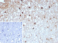 IHC staining of FFPE human brain tissue with GLUL antibody (clone GLUL/8996R). Inset: PBS used in place of primary Ab (secondary Ab negative control). HIER: boil tissue sections in pH 9 10mM Tris with 1mM EDTA for 20 min and allow to cool before testing.