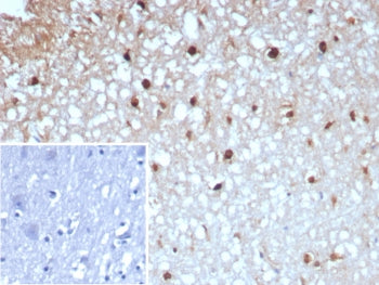 IHC staining of FFPE human brain tissue with GLUL antibody (clone GLUL/8996R). Inset: PBS used in place of primary Ab (secondary Ab negative control). HIER: boil tissue sections in pH 9 10mM Tris with 1mM EDTA for 20 min and allow to cool before testing.