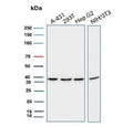 Western blot testing of human A431, 293T and HepG2 cell lysate and mouse NIH 3T3 cell lysate with PCNA antibody. Predicted molecular weight ~29 kDa, routinely observed at 29~36 kDa.