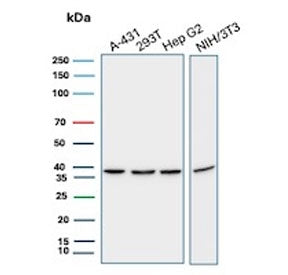 Western blot testing of human A431, 293T and HepG2 cell lysate and mouse NIH 3T3 cell lysate with PCNA antibody. Predicted molecular weight ~29 kDa, routinely observed at 29~36 kDa.