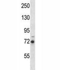 RIPK1 antibody western blot analysis in MDA-MB231 lysate.