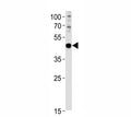 PAX6 antibody western blot analysis in U251 lysate. Predicted molecular weight ~48kDa.