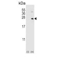 Western blot testing of 1) non-transfected and 2) transfected 293 cell lysate with HPRT1 antibody.