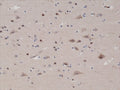 IHC testing of FFPE human brain tissue with recombinant PTEN antibody at 1:1000.