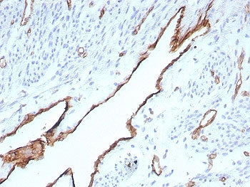 IHC staining of FFPE human placental tissue with CD31 antibody (clone rPECAM1/8832). HIER: boil tissue sections in pH 9 10mM Tris with 1mM EDTA for 20 min and allow to cool before testing.