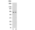 Western blot testing of NOX1 antibody and Lane 1: human HeLa; 2: human MCF-7 cell lysate.