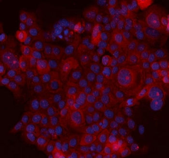 Immunofluorescent staining of FFPE human A431 cells with SERPINB5 antibody (red) and DAPI nuclear stain (blue). HIER: steam section in pH6 citrate buffer for 20 min.