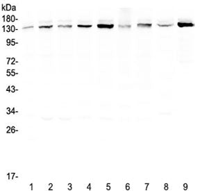 Western blot testing of human 1) HeLa, 2) 22RV1, 3) A431, 4) HepG2, 5) HepG2, 6) SGC-7901, 7) A549, 8) rat brain and 9) mouse testis lysate with USP7 antibody at 0.5ug/ml. Predicted molecular weight ~128 kDa, observed at ~135 kDa.