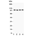 Western blot testing of TRPC7 antibody and Lane 1: mouse brain; 2: human A549; 3: (h) COLO320; 4: (h) SKOV. Expected molecular weight ~100 kDa.