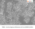 Acral Lentiginous Melanoma Cell Line (MM011/LND1) | Applied Biological Materials (abm)