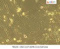 OVJ-111T (GYN-111) Cell Line | Applied Biological Materials (abm)