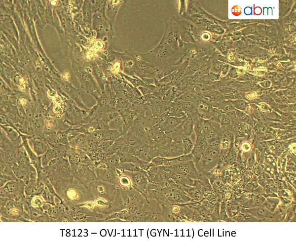 OVJ-111T (GYN-111) Cell Line | Applied Biological Materials (abm)