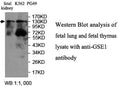Anti-GSE1 Antibody – Figure 1 of 1