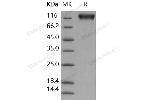 Recombinant Human MERTK/MER Protein (His & Fc Tag) – Figure 1 of 2