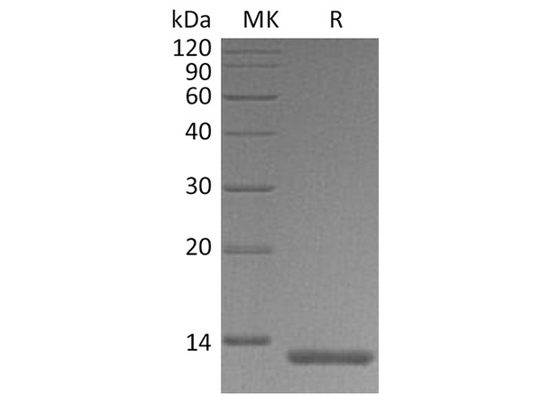 Recombinant Human S100A4 Protein (His Tag) – Figure 1 of 2