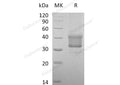 Recombinant Human TNFRSF1B/CD120b Protein (aa 288-461, His Tag) – Figure 1 of 2