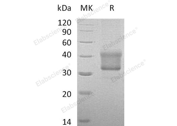 Recombinant Human TNFRSF1B/CD120b Protein (aa 288-461, His Tag) – Figure 1 of 2