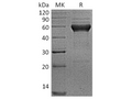 Recombinant Human ALK-1/ACVRL1 Protein (Fc Tag) – Figure 1 of 2