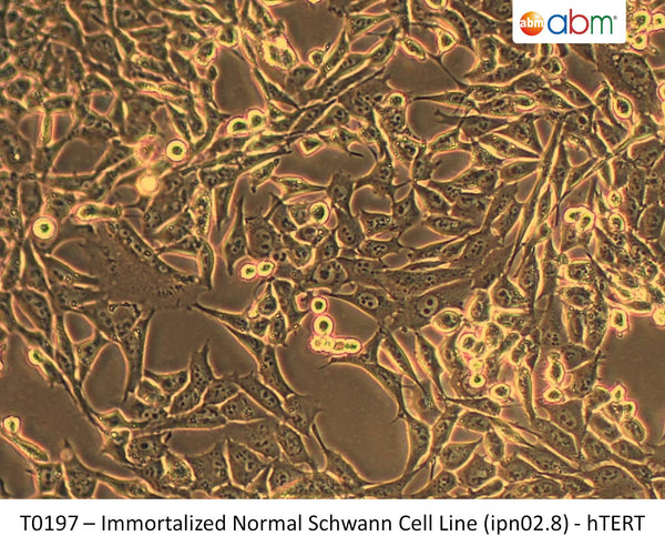 Immortalized Normal Schwann Cell Line (ipn02.8) - hTERT | Applied Biological Materials (abm)