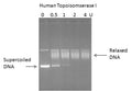 Gel-Based Human Topoisomerase I DNA Relaxation Assay Kit – Figure 1 of 1