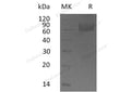 Recombinant Human IL18BP Protein (Fc Tag) – Figure 1 of 2