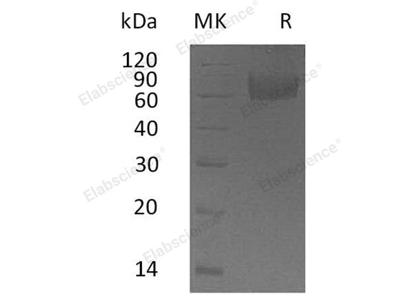 Recombinant Human IL18BP Protein (Fc Tag) – Figure 1 of 2