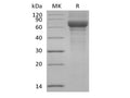 Recombinant Human Vitronectin/VTN (N-Truncated, C-6His) – Figure 1 of 2