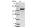 Recombinant Rift Valley fever virus (RVFV) (strain MP12) glycoprotein / G2 Protein (His Tag) – Figure 1 of 2
