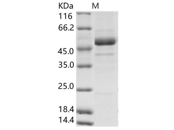 Recombinant Rift Valley fever virus (RVFV) (strain MP12) glycoprotein / G2 Protein (His Tag) – Figure 1 of 2