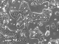 HaCaT-ras A5 cell