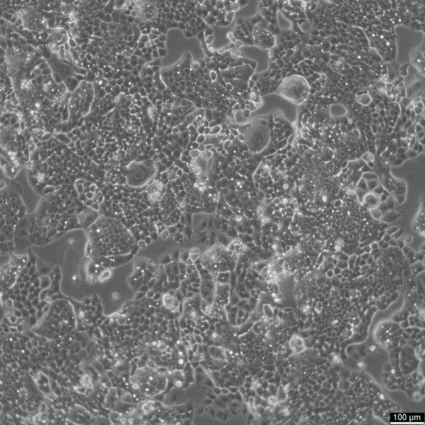 HARA-B cell