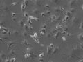 HBL-52 cell
